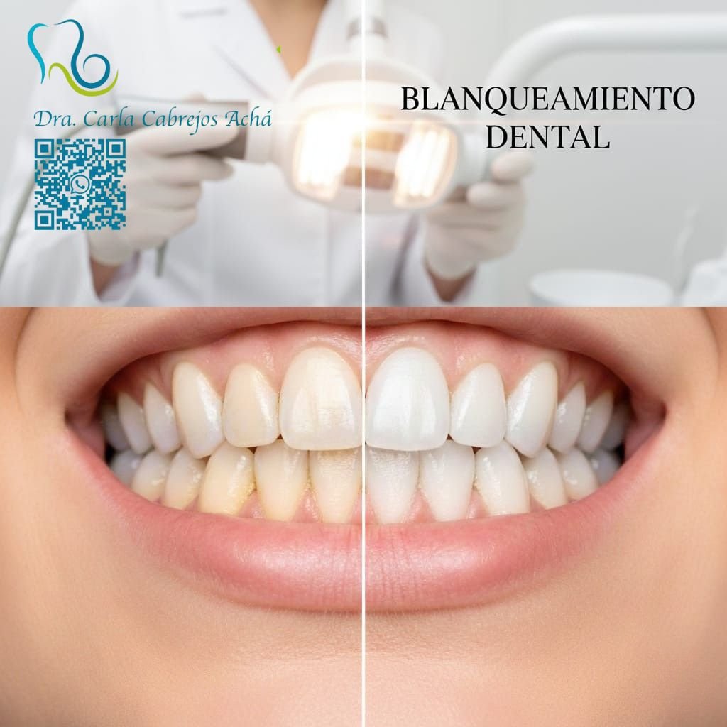 BLANQUEAMIENTO DENTAL