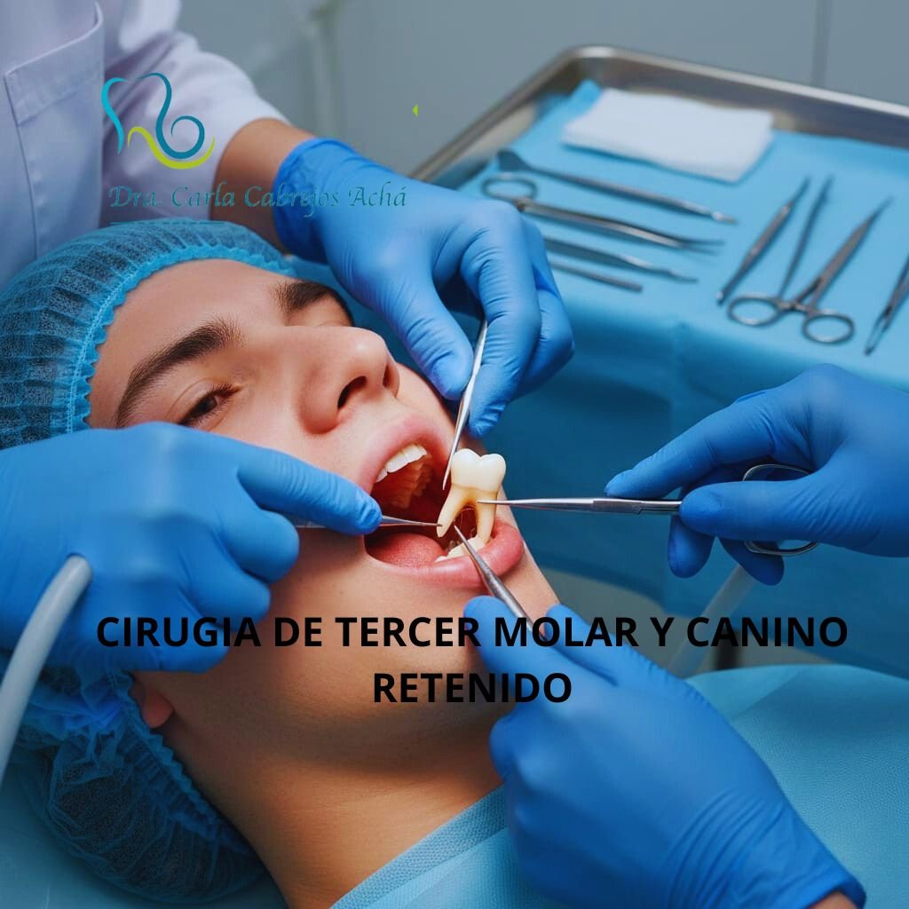 CIRUGIA DE TERCER MOLAR Y CANINO RETENIDO