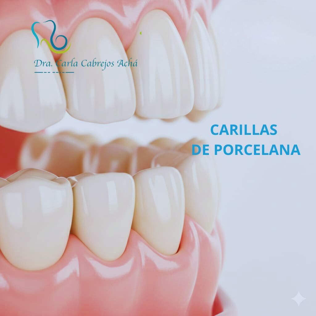 CARILLAS DE PORCELANA
