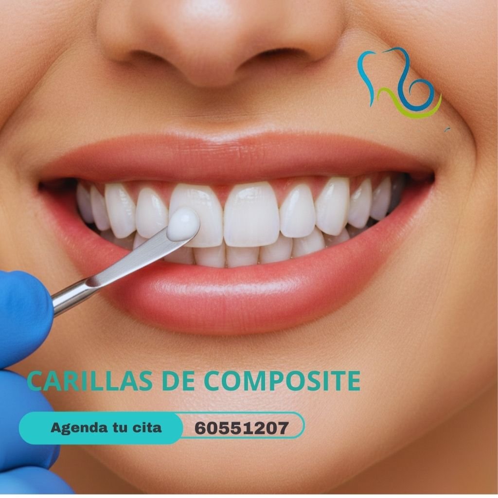 CARILLAS DE COMPOSITE