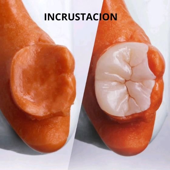 INCRUSTACION