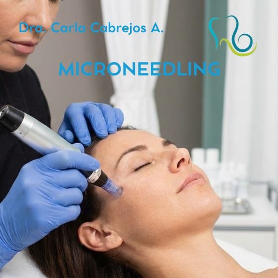MICRONEEDLING