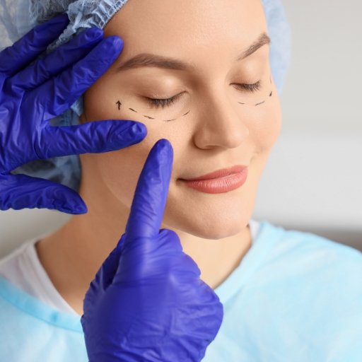 Blefaroplastia