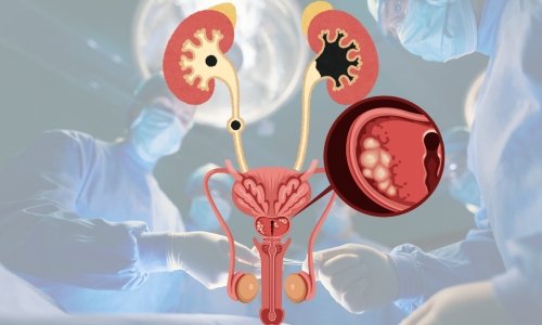 TRATAMIENTOS MEDICOS