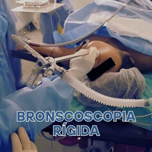 Broncoscopia Rigida