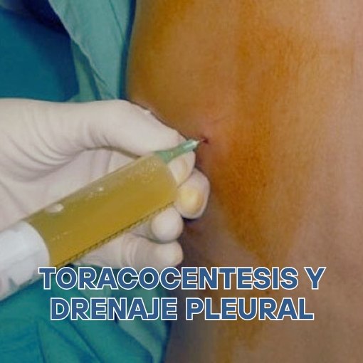 Toracocentesis y Drenaje Pleural