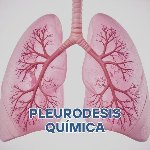 Pleurodesis Química