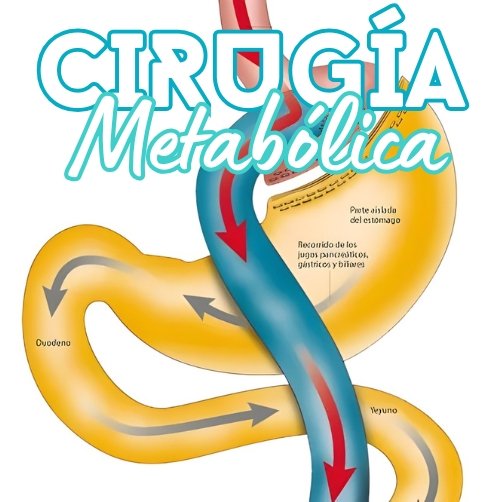 Cirugia Metabólica
